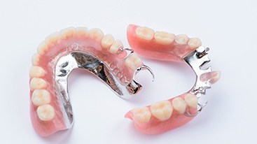 Two sets of partial dentures with metal clasps on a white surface