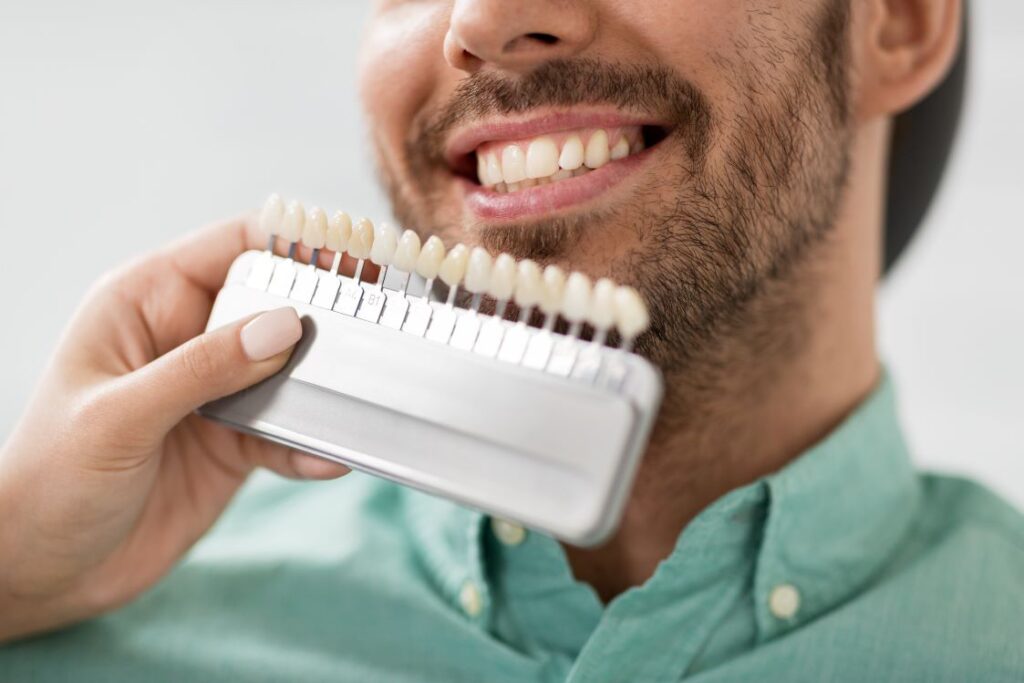 A man smiling by a tooth shade guide